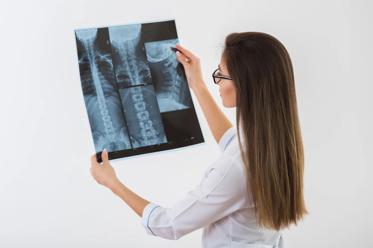 Cirugía de malformación de chiari en Zapopan, Jalisco: Solución Neuroquirúrgica Avanzada