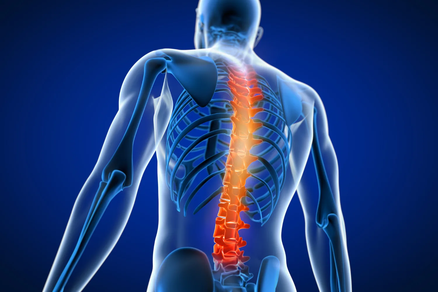 Vertebroplastia o Cifoplastia en Zapopan, Jalisco: Tratamiento Avanzado para Fracturas Vertebrales